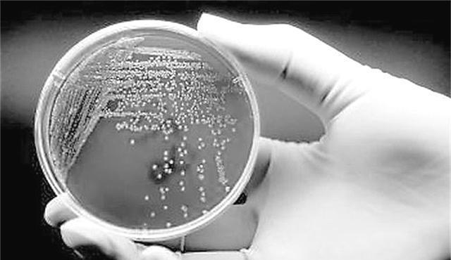 为了赚钱，我投身Microbial Sector，一份观察微生物工作的六种结局！